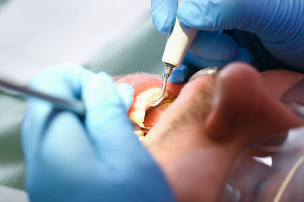 Best Emergency Cosmetic Dentistry (e.g., broken veneers) in Ottawa, KS